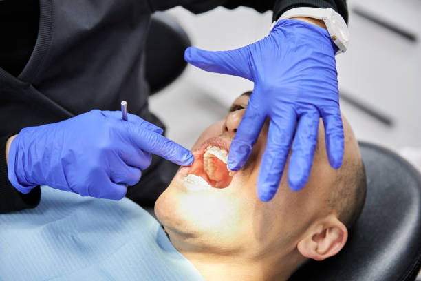 Best Broken or Chipped Tooth Repair in Thousand Palms, CA
